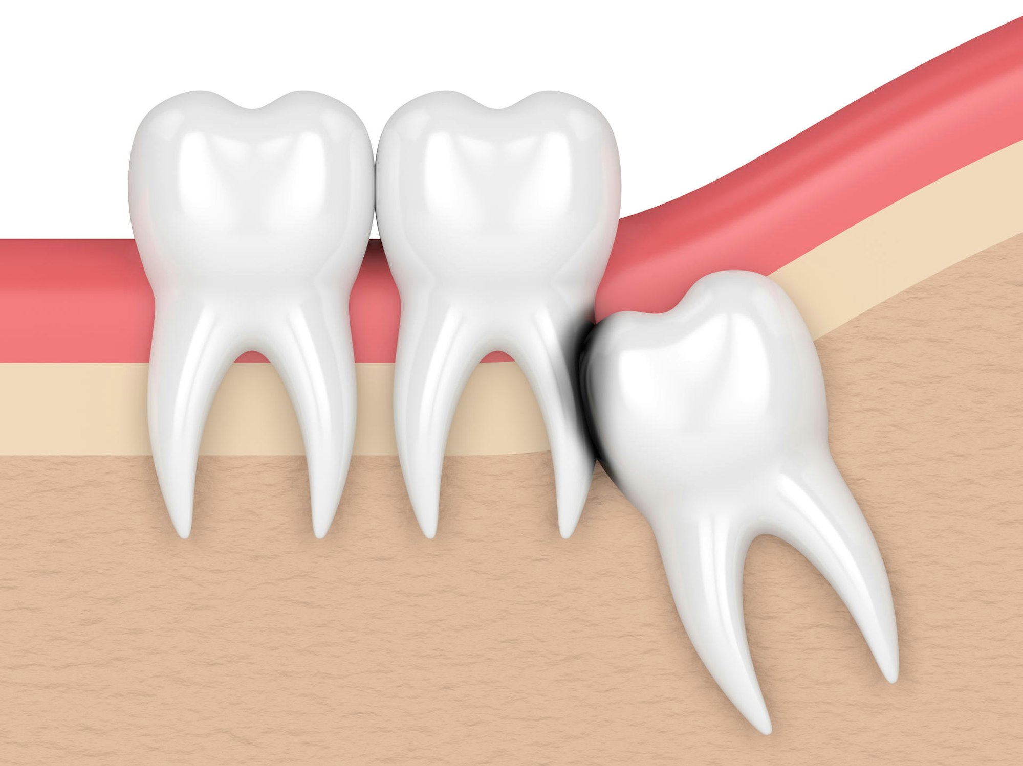 AdobeStock_203873084