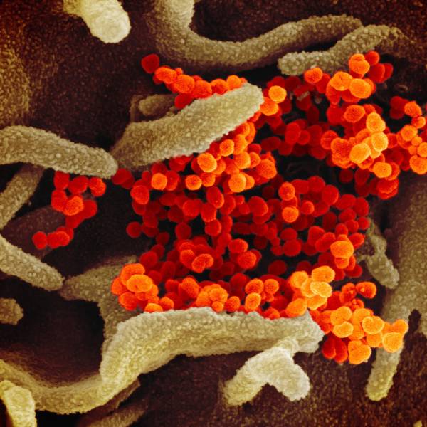 20200303coronavirus-003