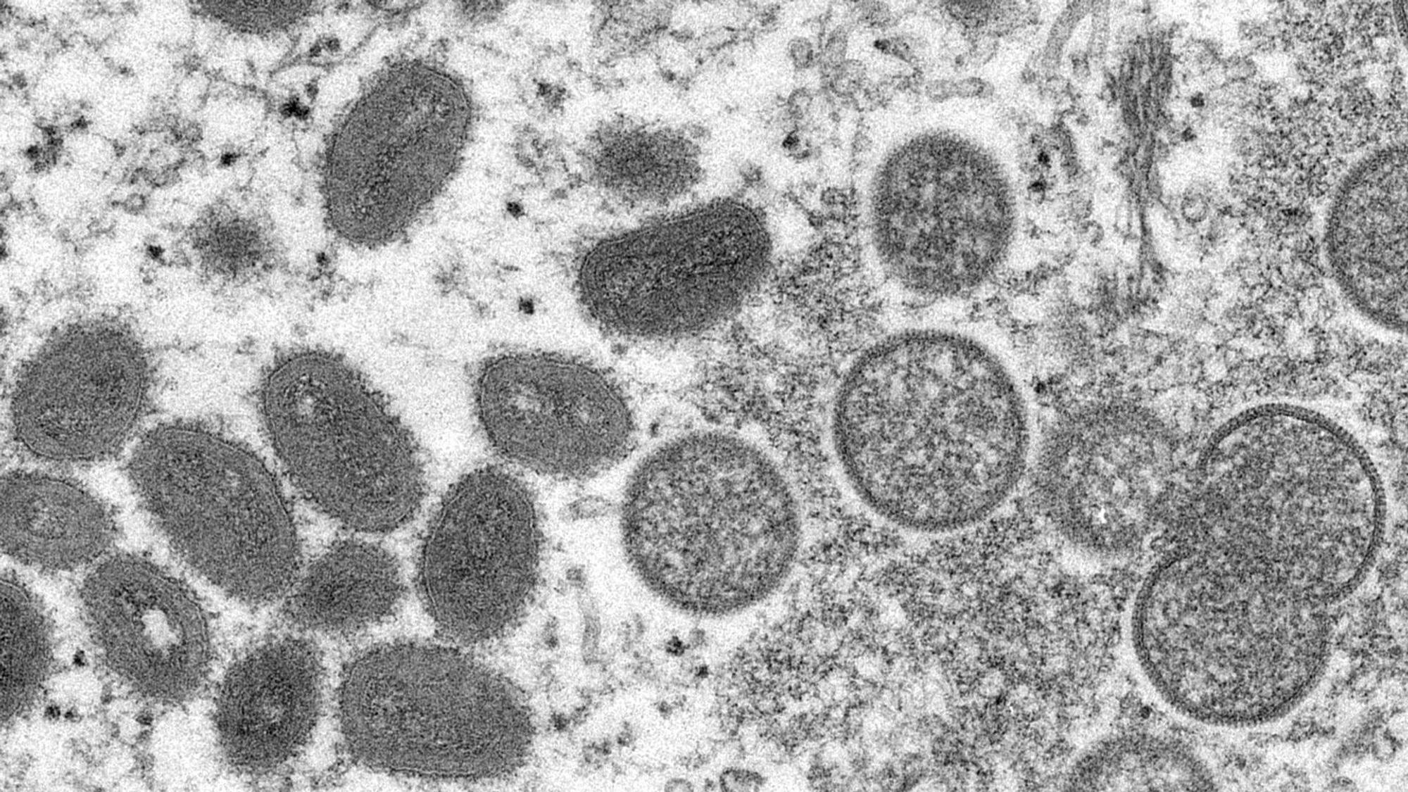 Das Mpox Virus unter dem Mikroskop.
