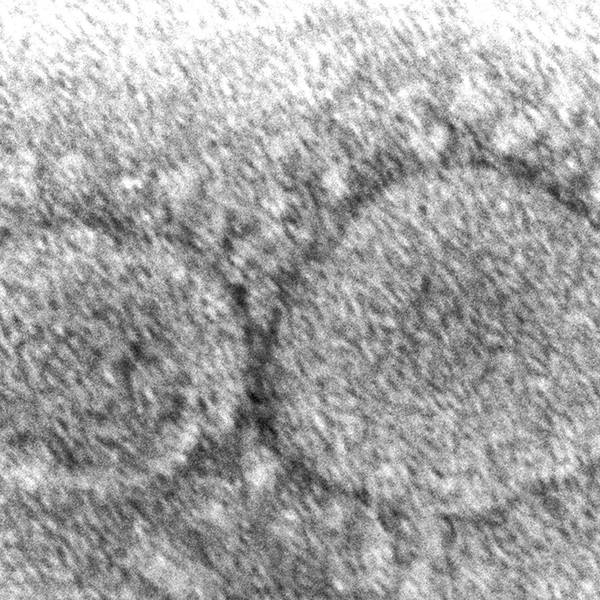 SARS-Cov-2 Schwarz weiß Elektronenmikroskop