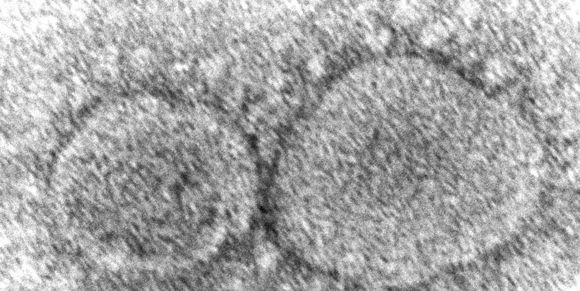 SARS-Cov-2 Schwarz weiß Elektronenmikroskop