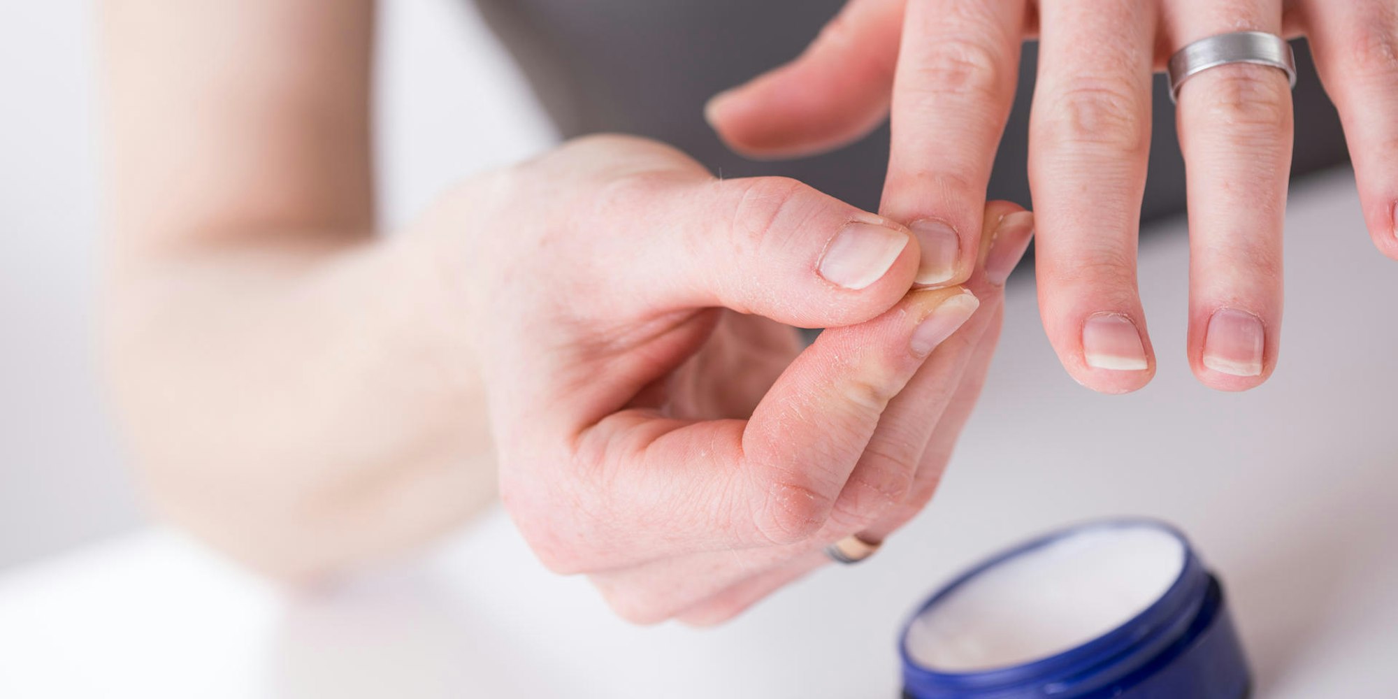 Gesunde_Fingernägel_benötigen_viel_Pflege