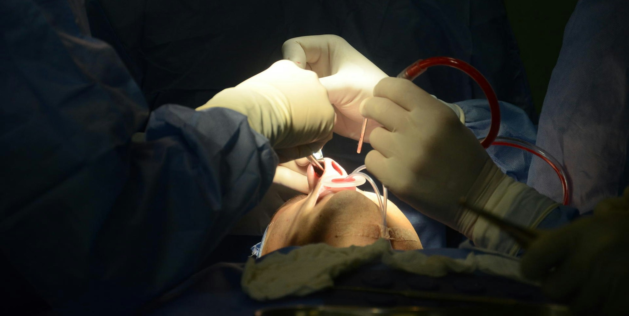 Schoenheitsoperation