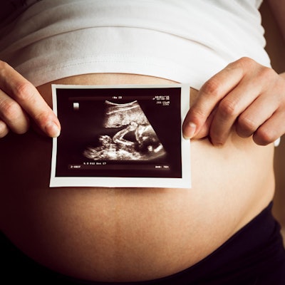 GettyImages-477718252