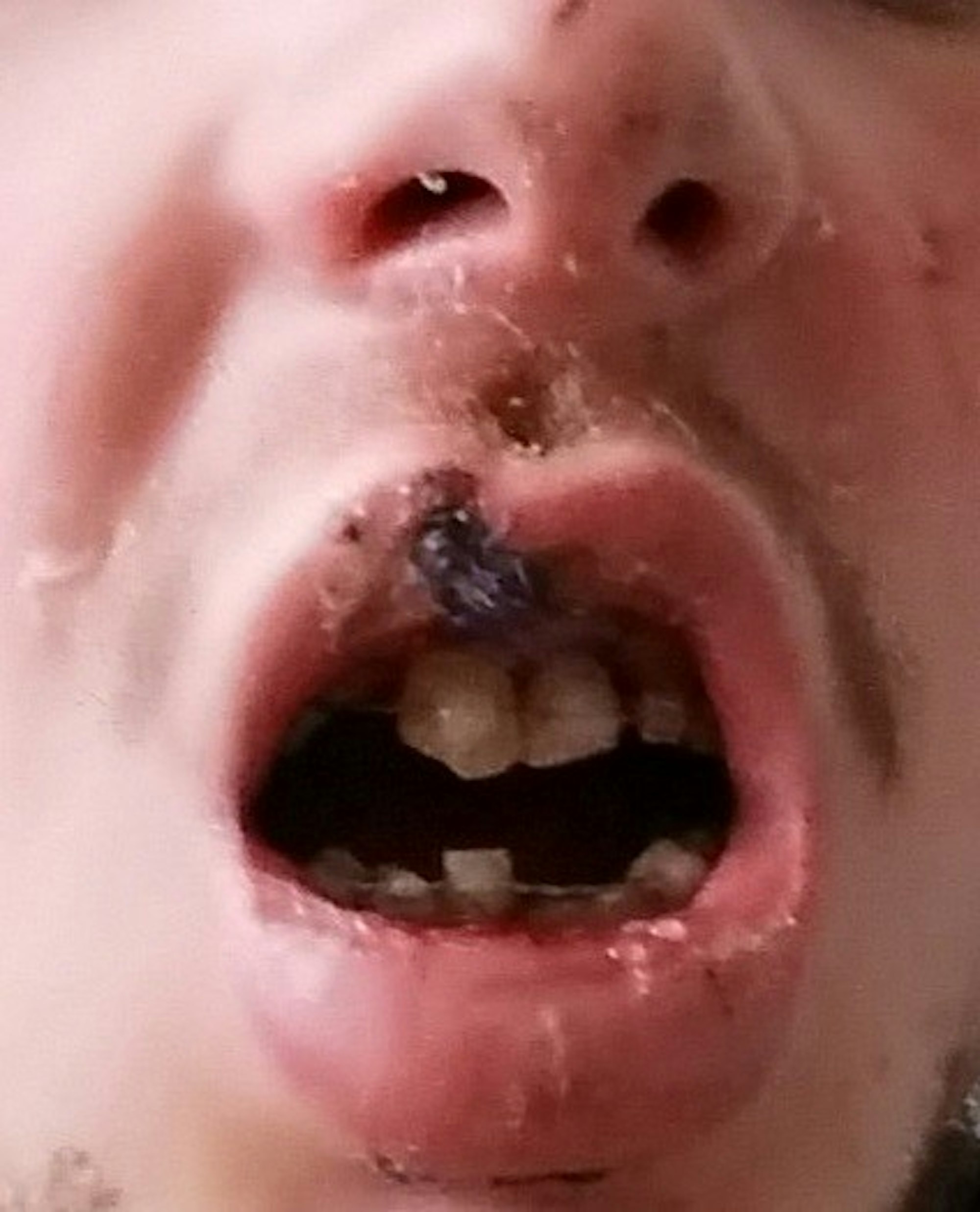 EZigarette_Explosion