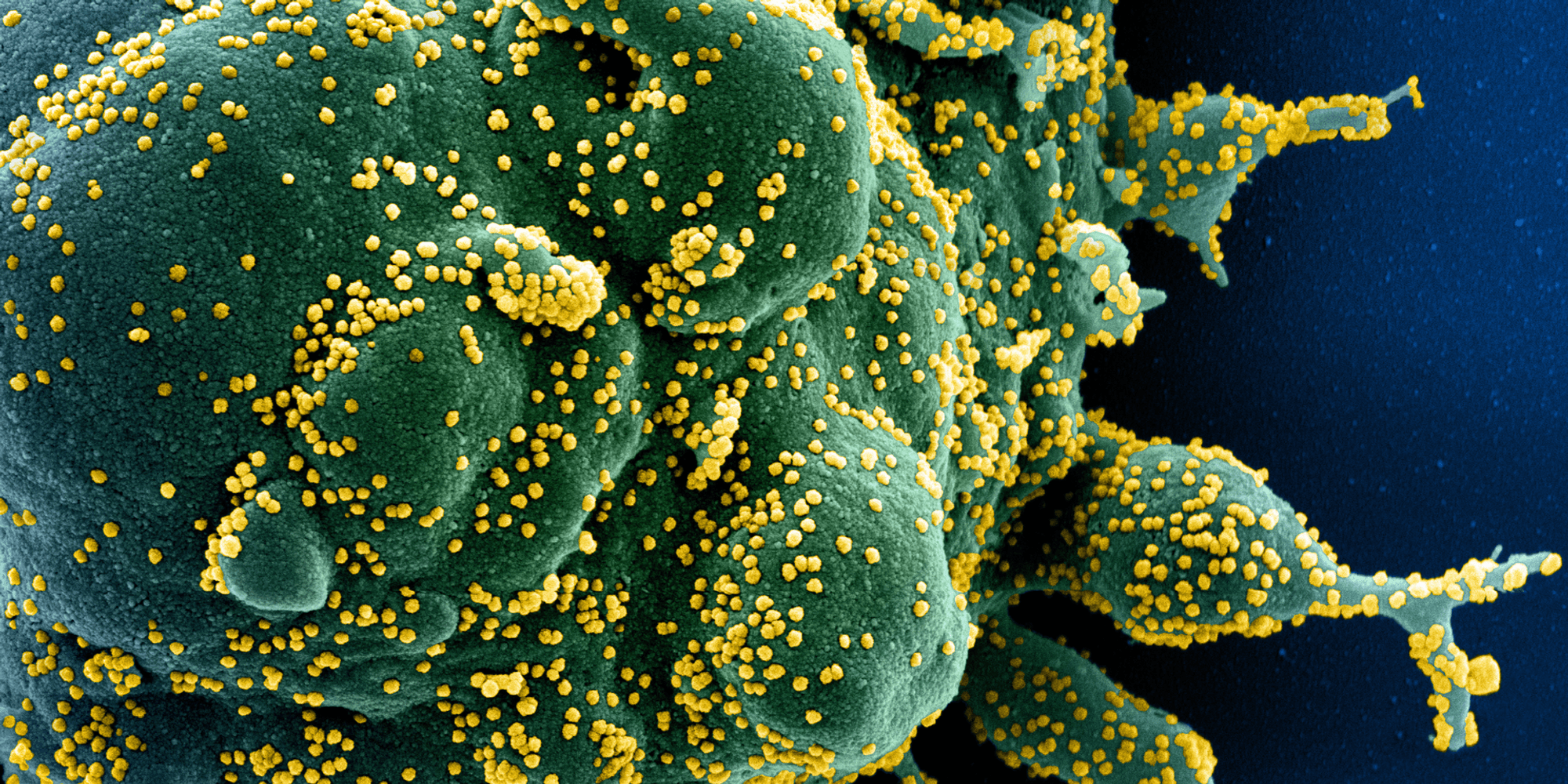 Coronavirus DPA SYMBOL 260922