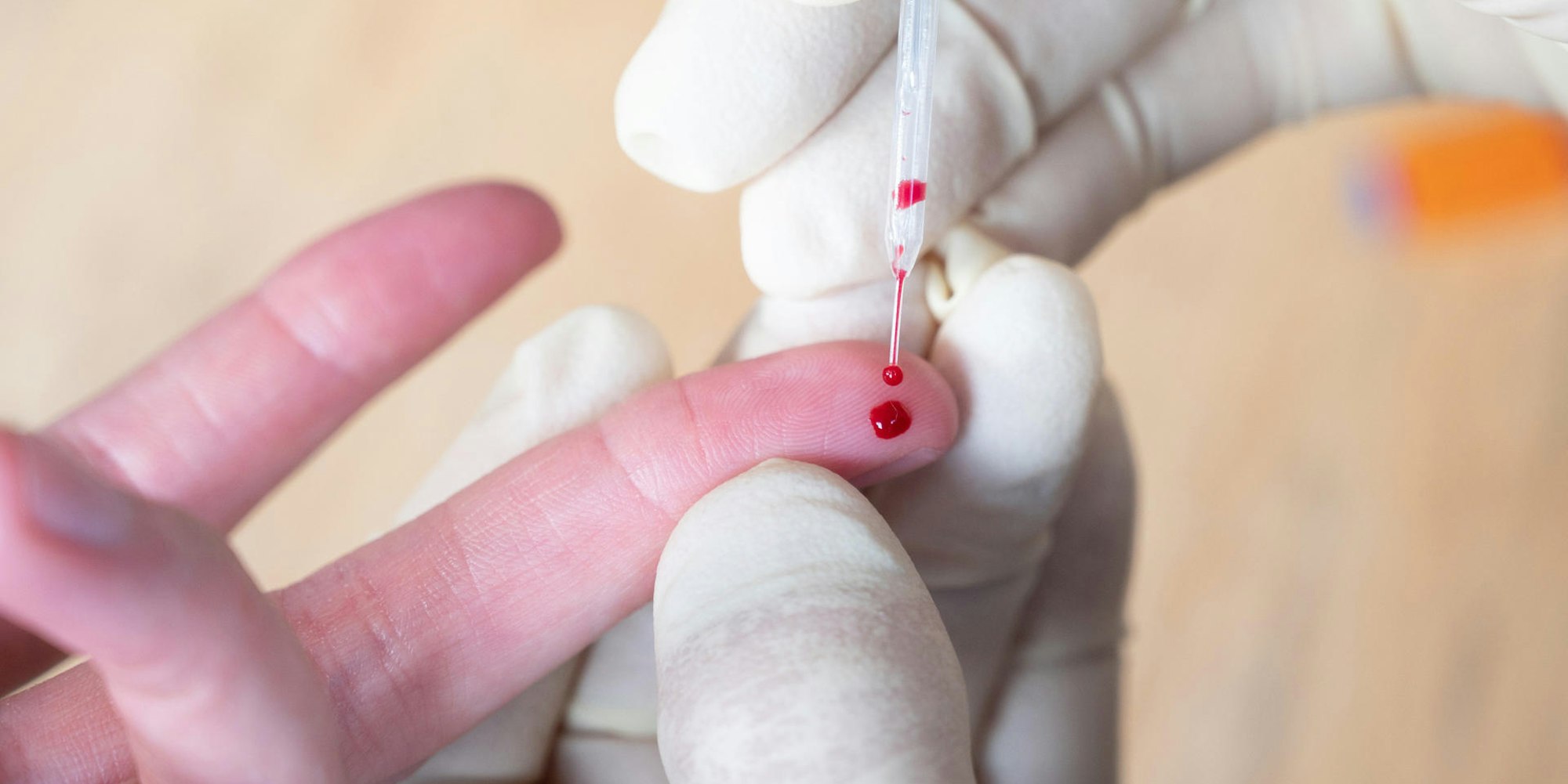 Symbolbild Antikörper-Test