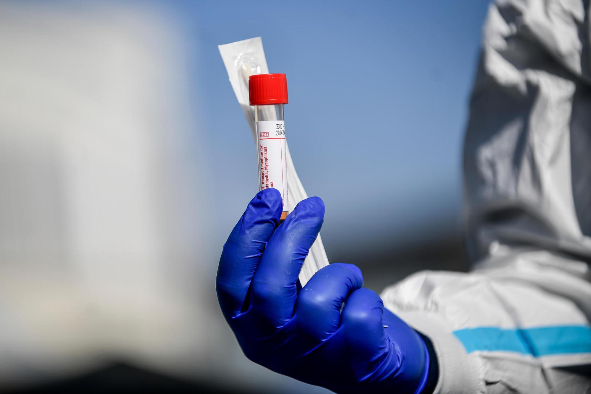 Testbesteck_Coronavirus
