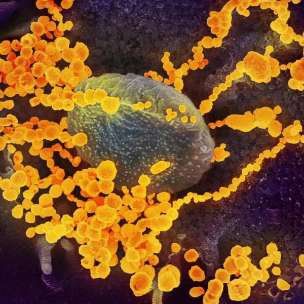 20200303coronavirus-002