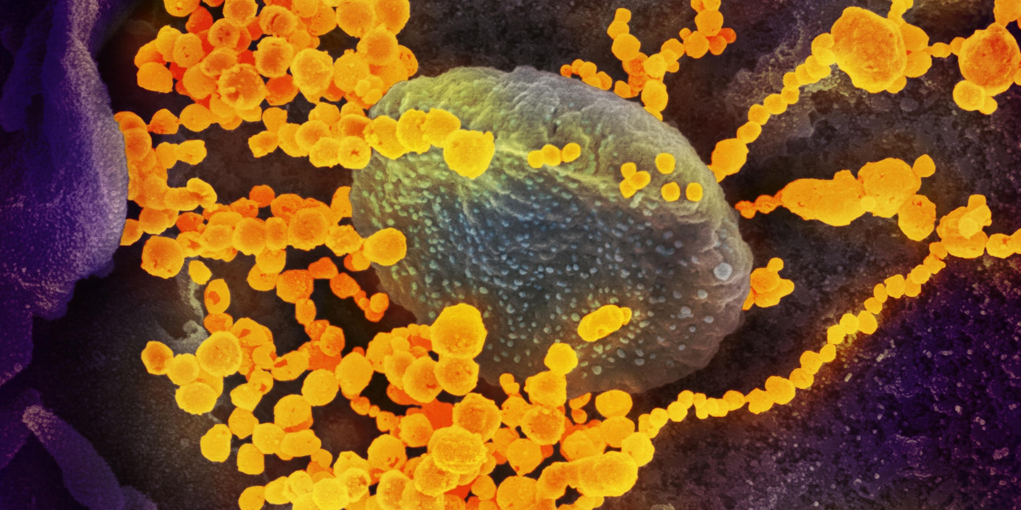 20200303coronavirus-002