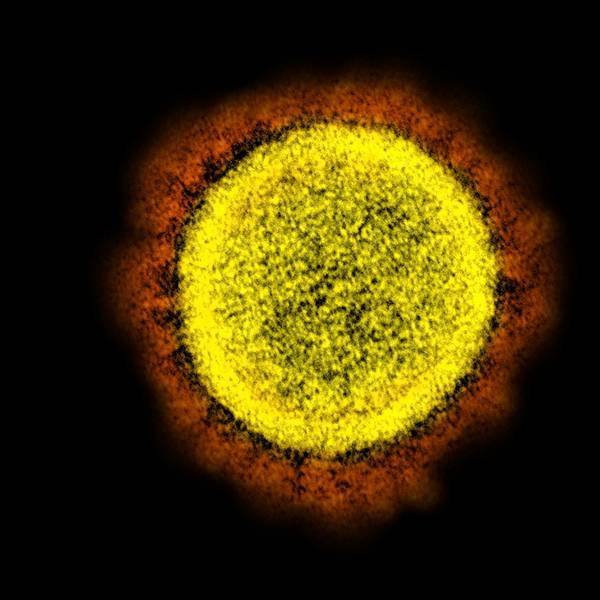 Coronavirus_Partikel