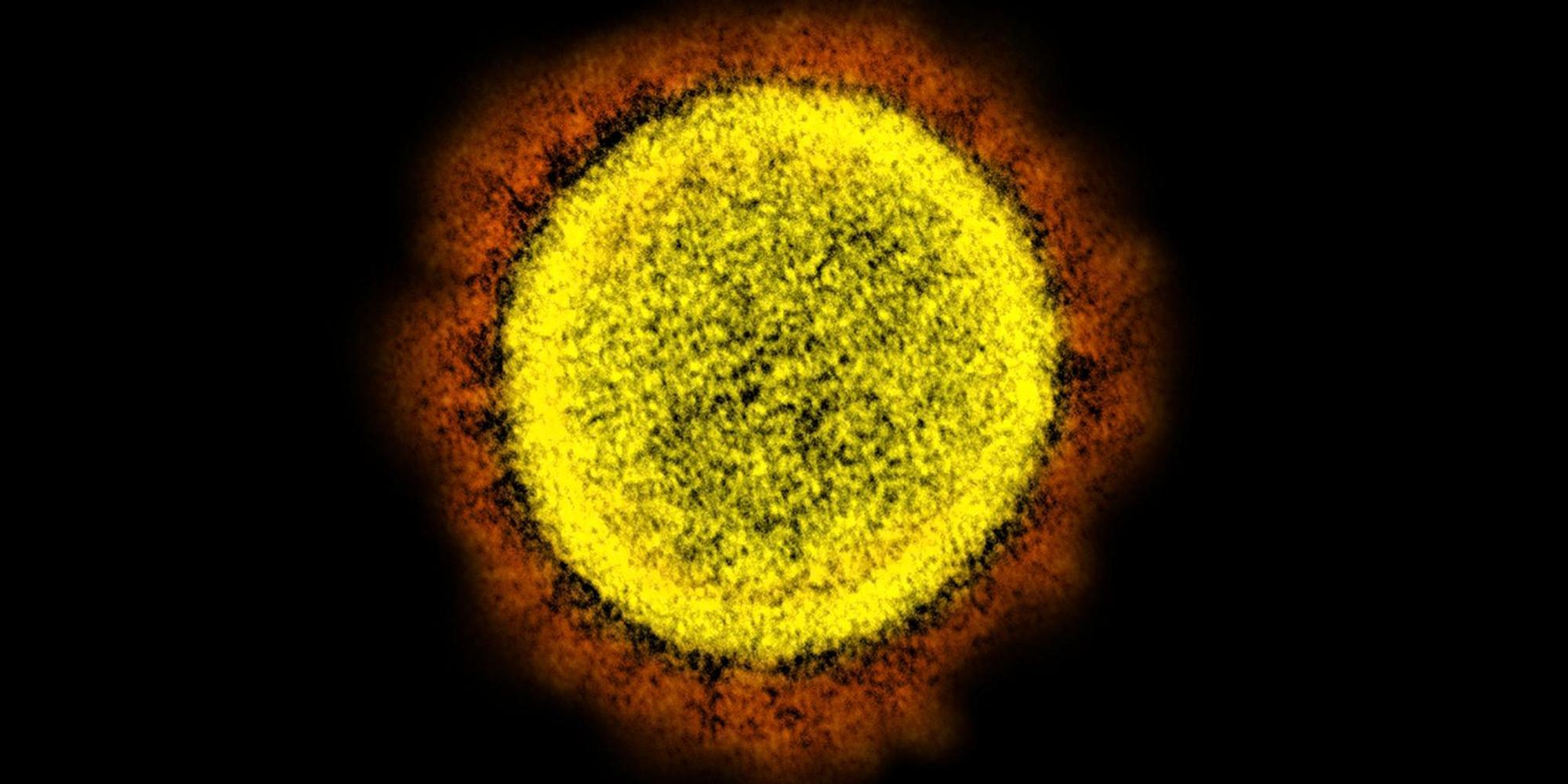 Coronavirus_Partikel