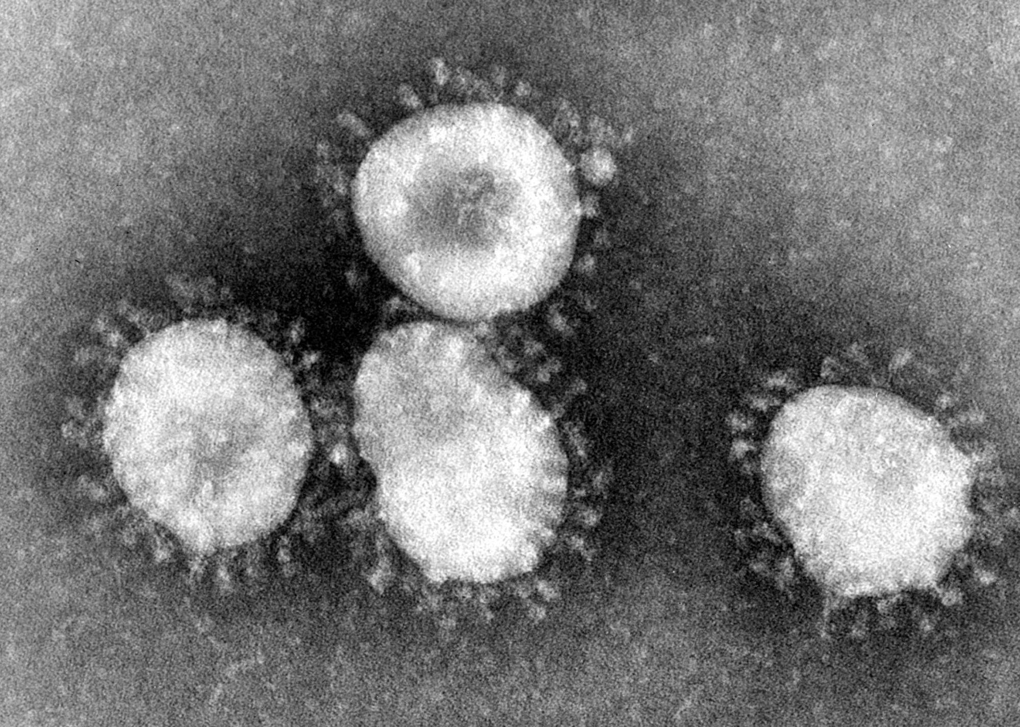 Mers_Virus_dpa