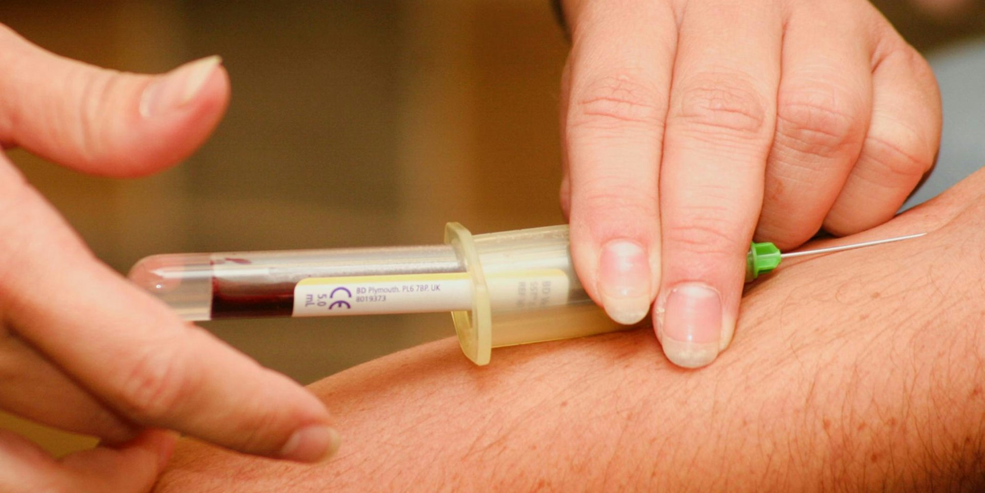 Blutentnahme Symbolbild