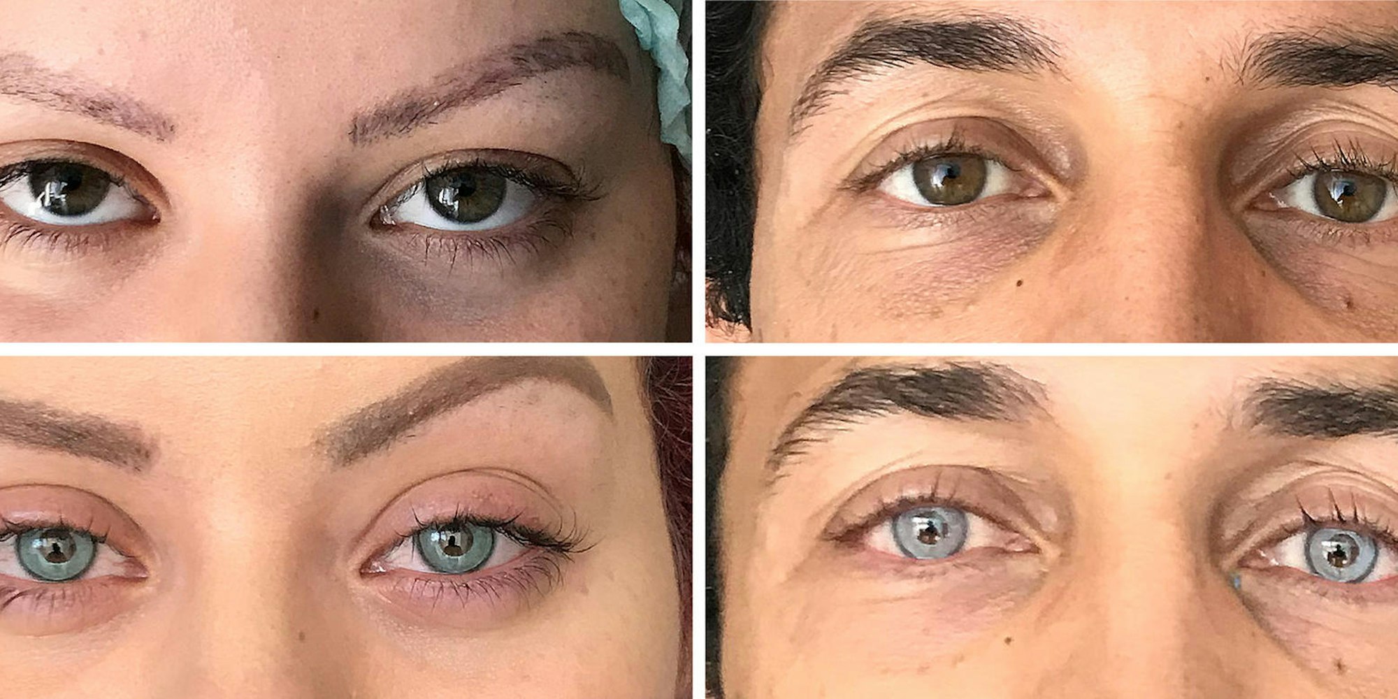 Augenfarbe durch Tattoo verändern