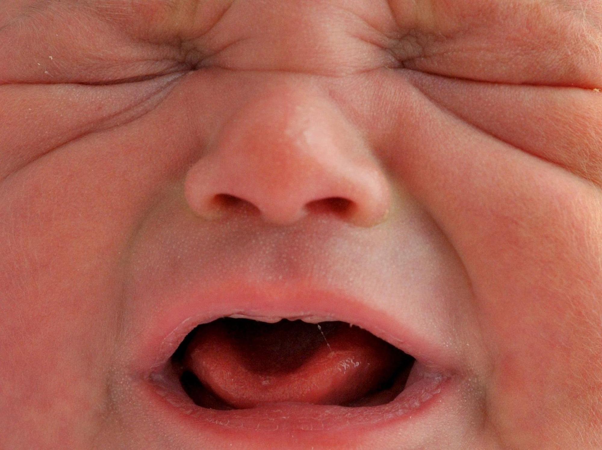 Baby schreit_Symbol