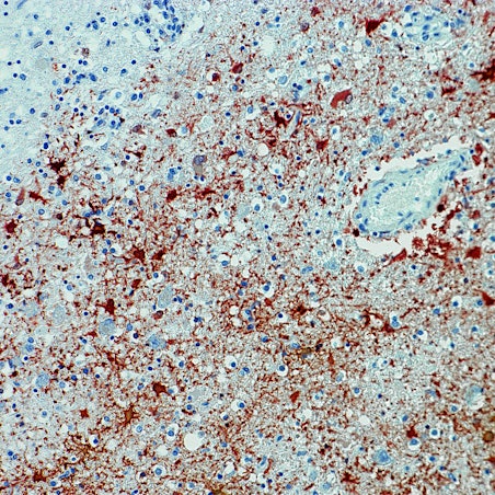 Borna-Virus DPA 080622