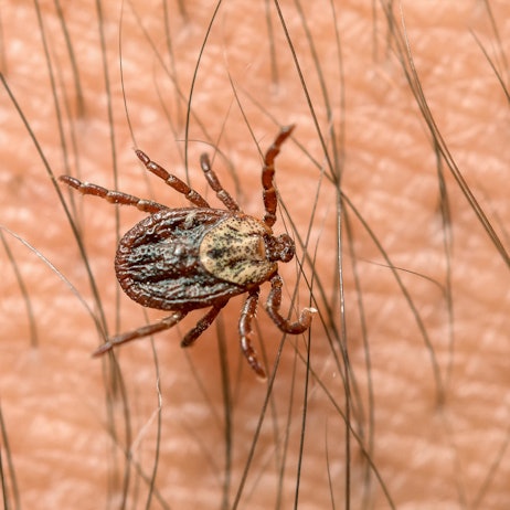 Zecke läuft über den Körper eines Menschen