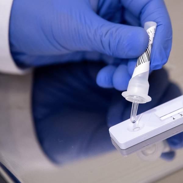 Antigen-Test 2