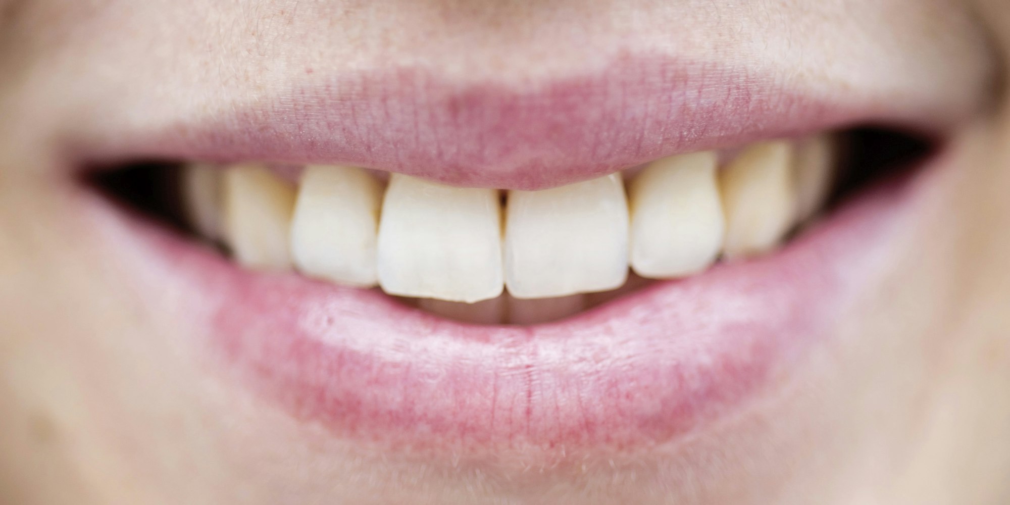 Gebiss_weiße_Zähne_dpa