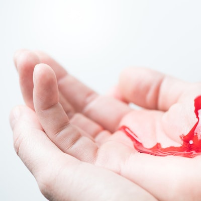 Blutige Wunde an der Hand
