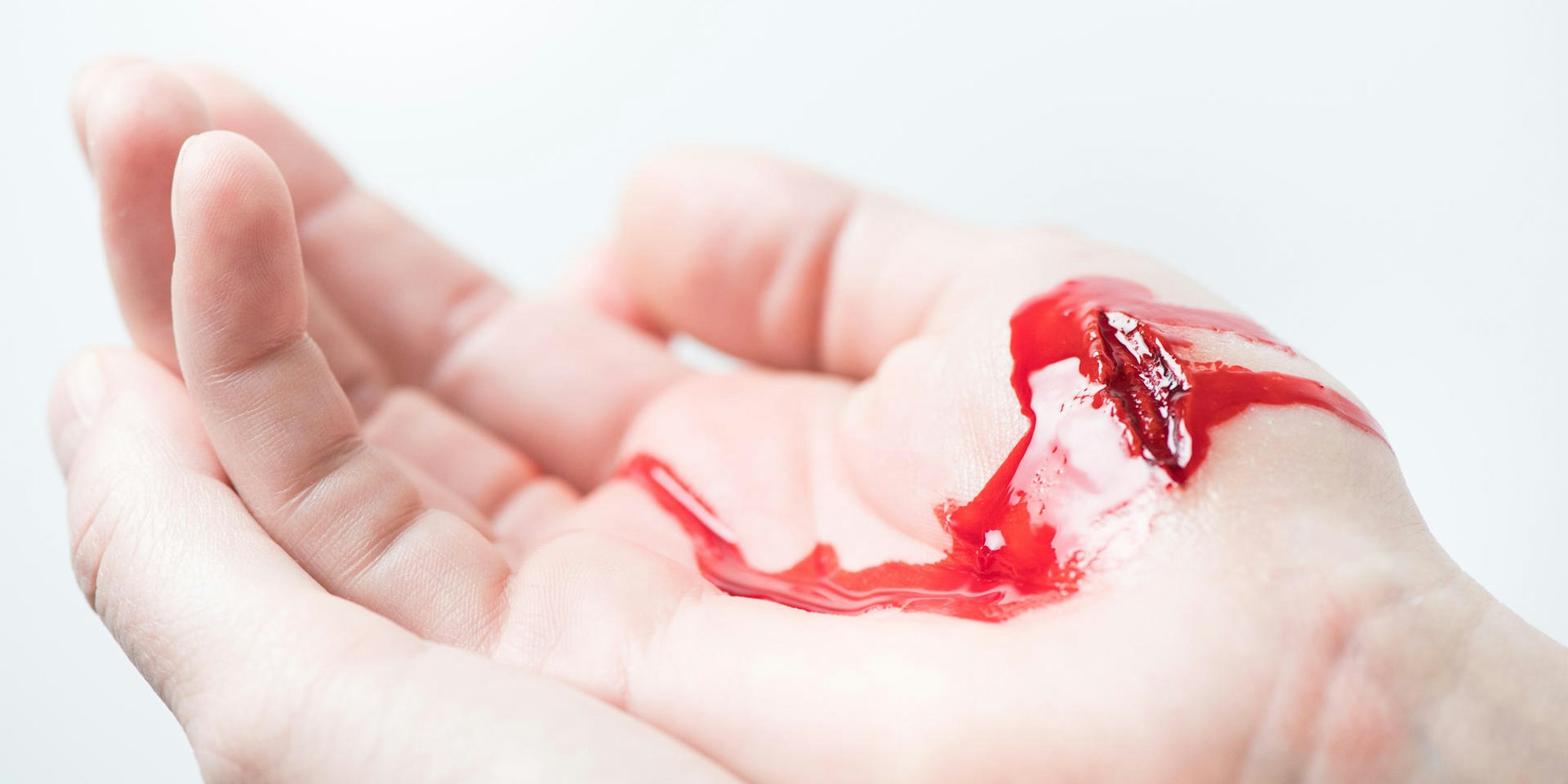Blutige Wunde an der Hand