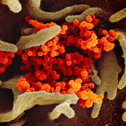 Coronavirus Elektronenmikroskop