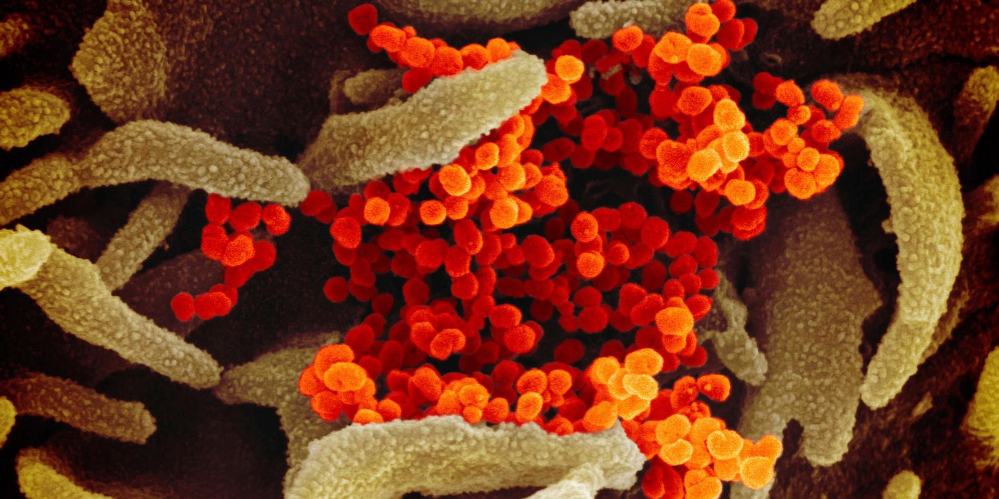 Coronavirus Elektronenmikroskop