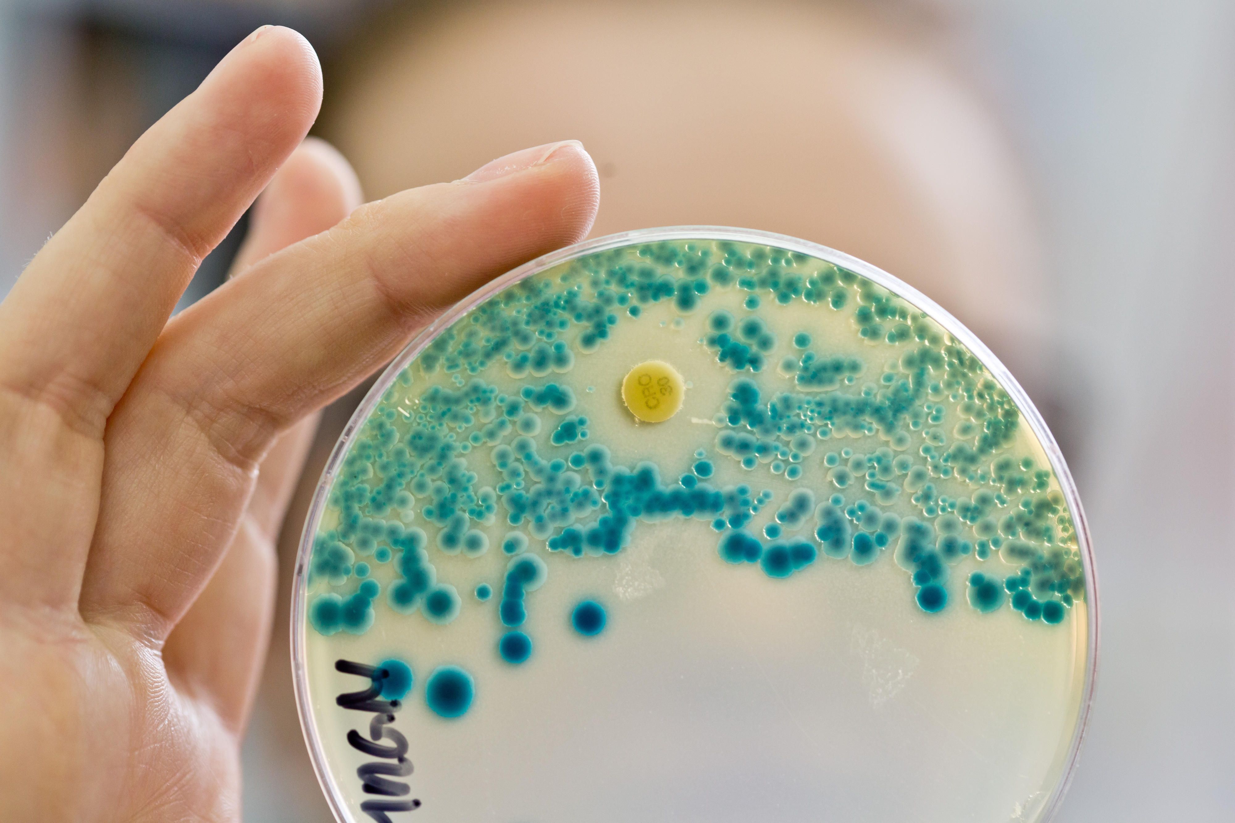 Notfall-Antibiotikum_Resistenz_Labor_Petrischale