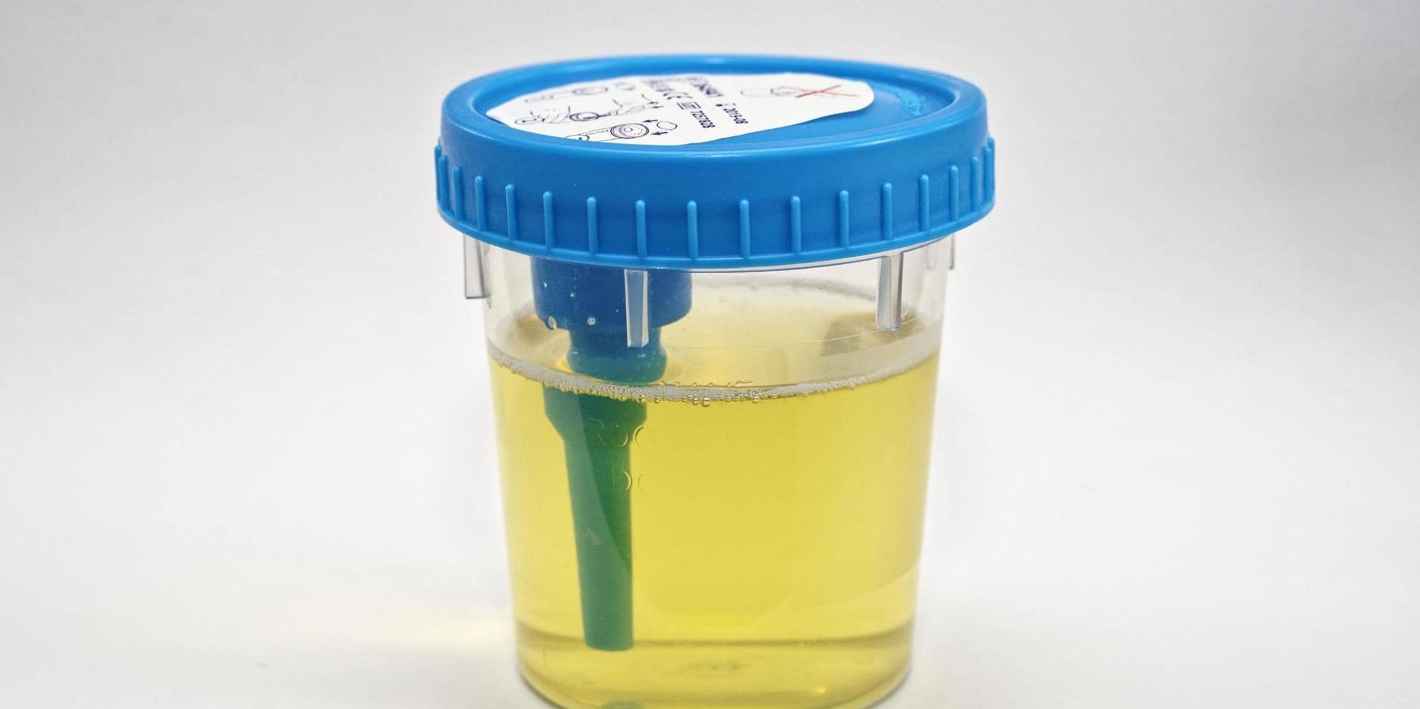 Urinprobe