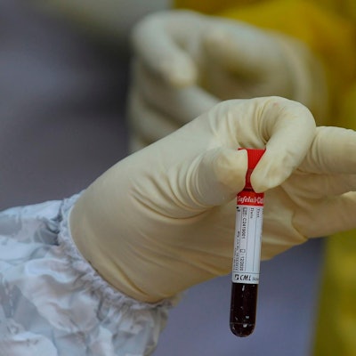 Blutprobe