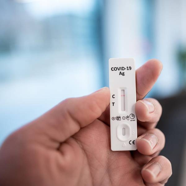 Schnelltest Arbeitgeber