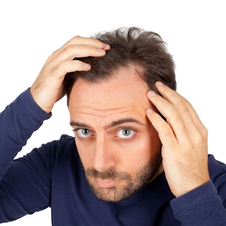 Haarausfall_Header_imago