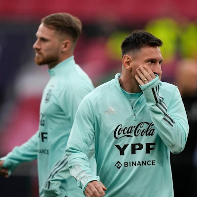 Messi hält sich die Wange