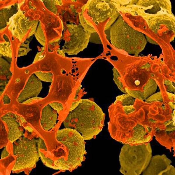 REM infektionen antibiotkika helfen nicht