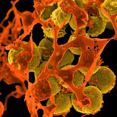 REM infektionen antibiotkika helfen nicht