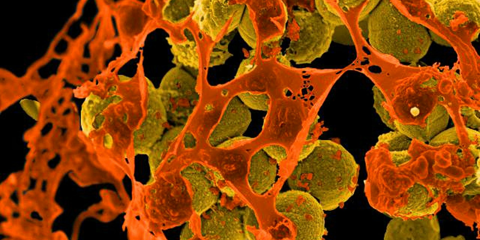 REM infektionen antibiotkika helfen nicht