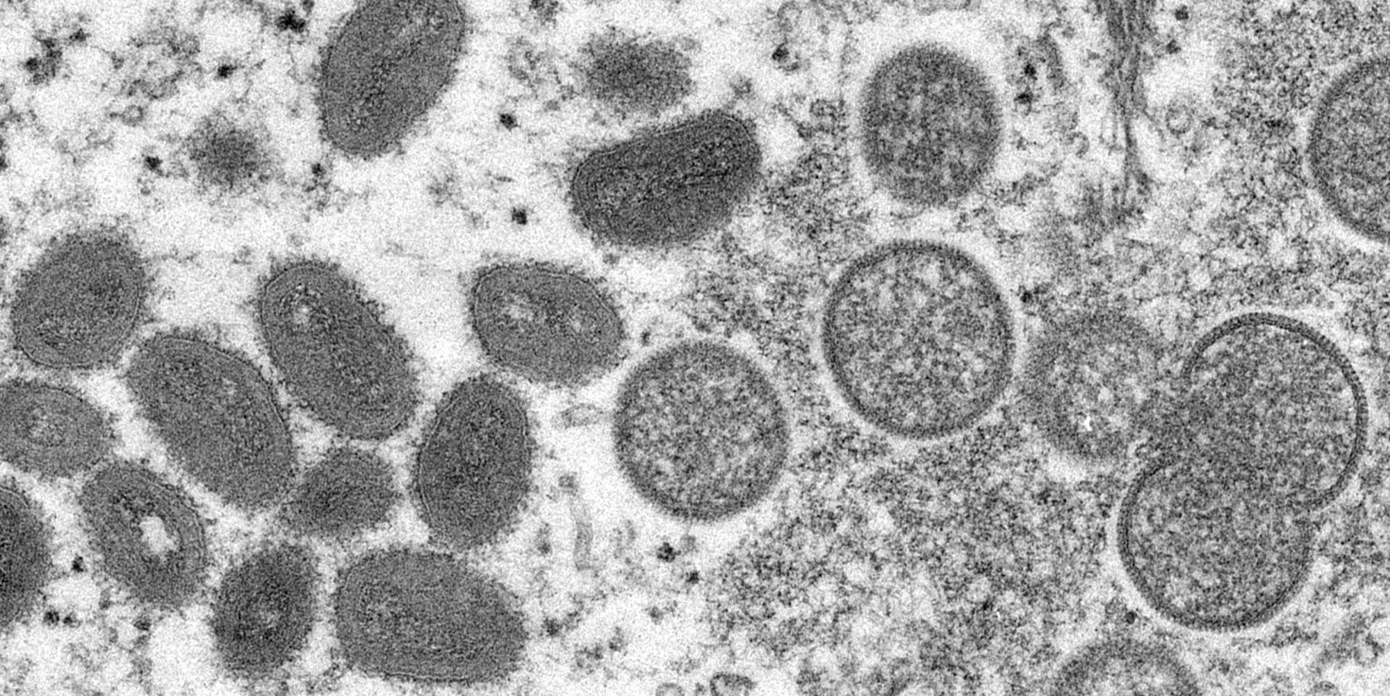 Affenpocken Mirkoskop