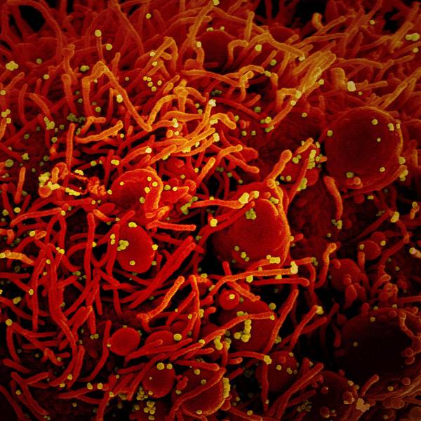 Coronavirus Symbol rot-gelb DPA 100122