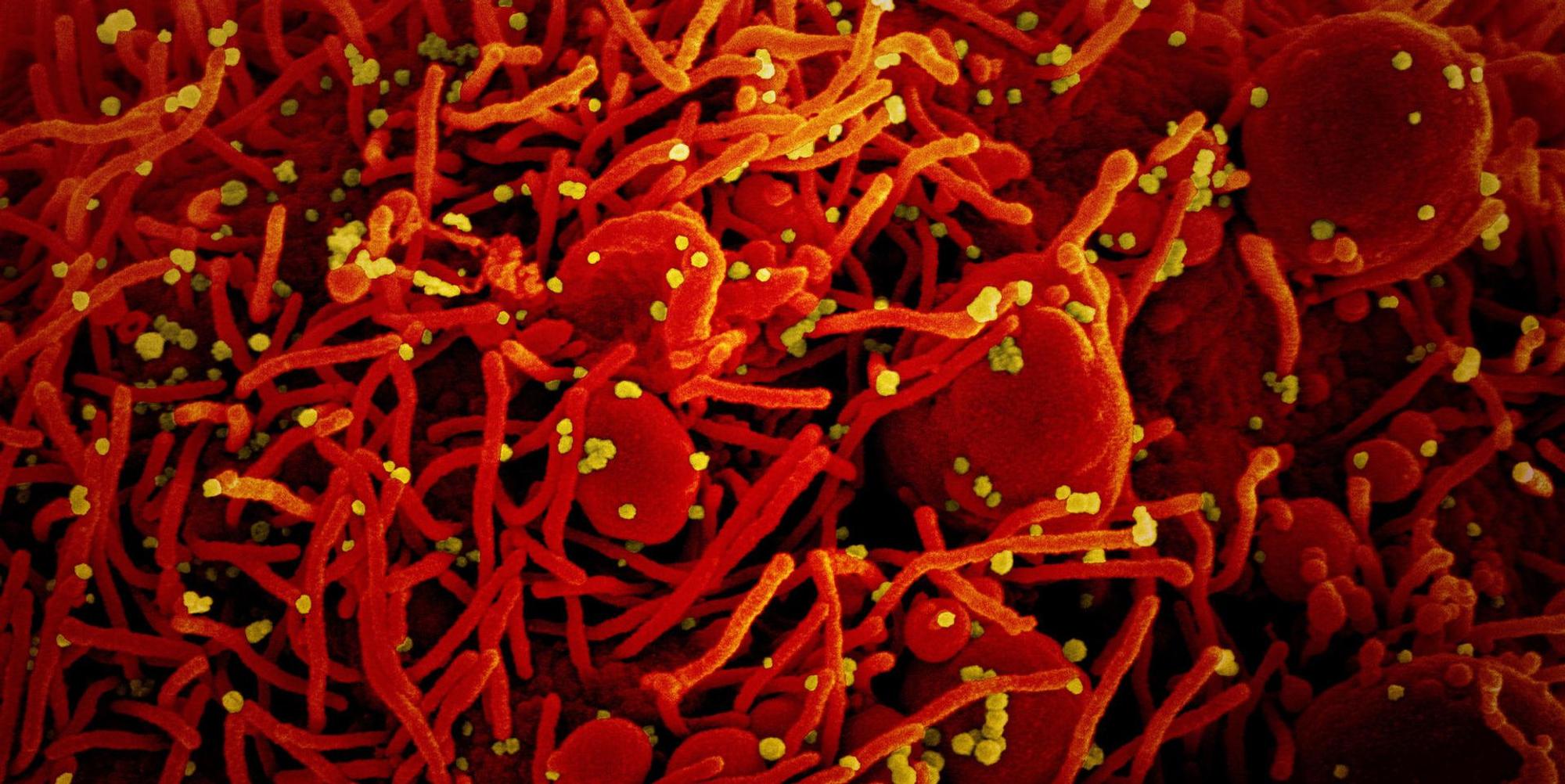 Coronavirus Symbol rot-gelb DPA 100122