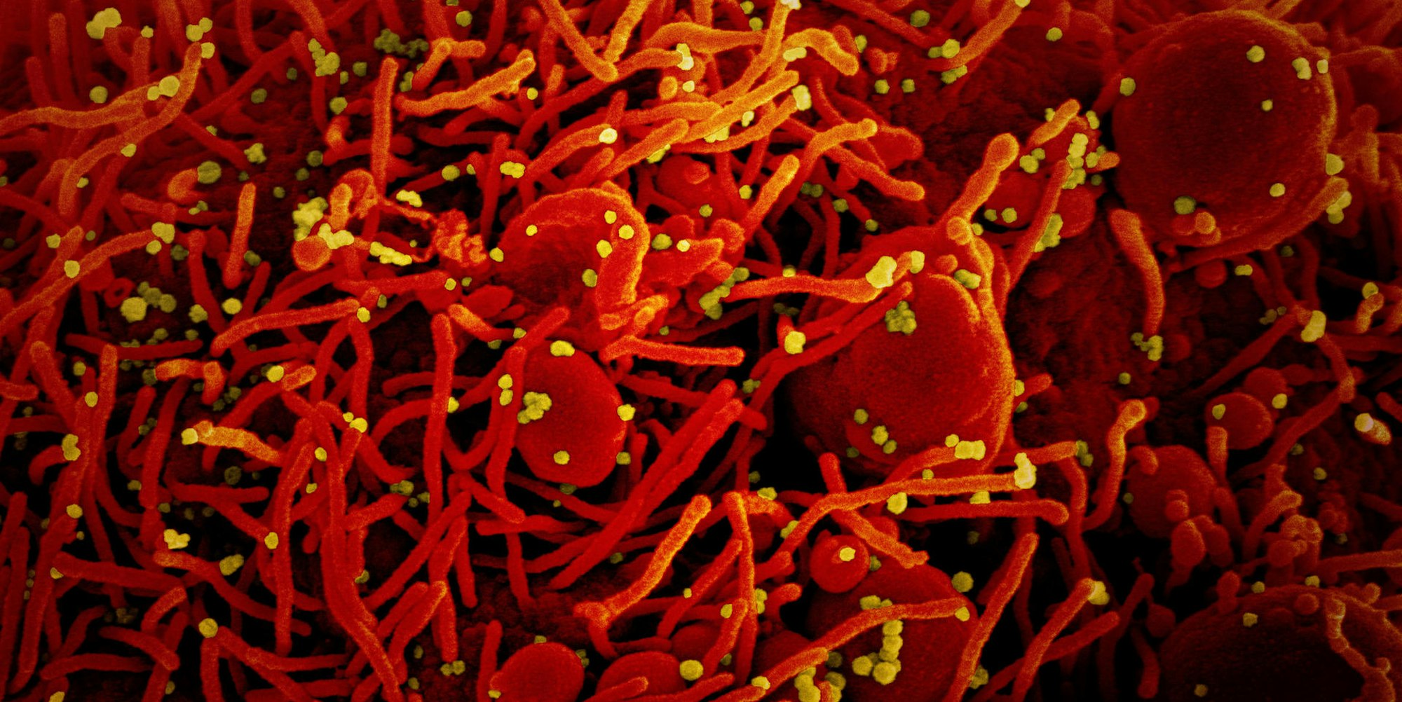 Coronavirus Symbol rot-gelb DPA 100122