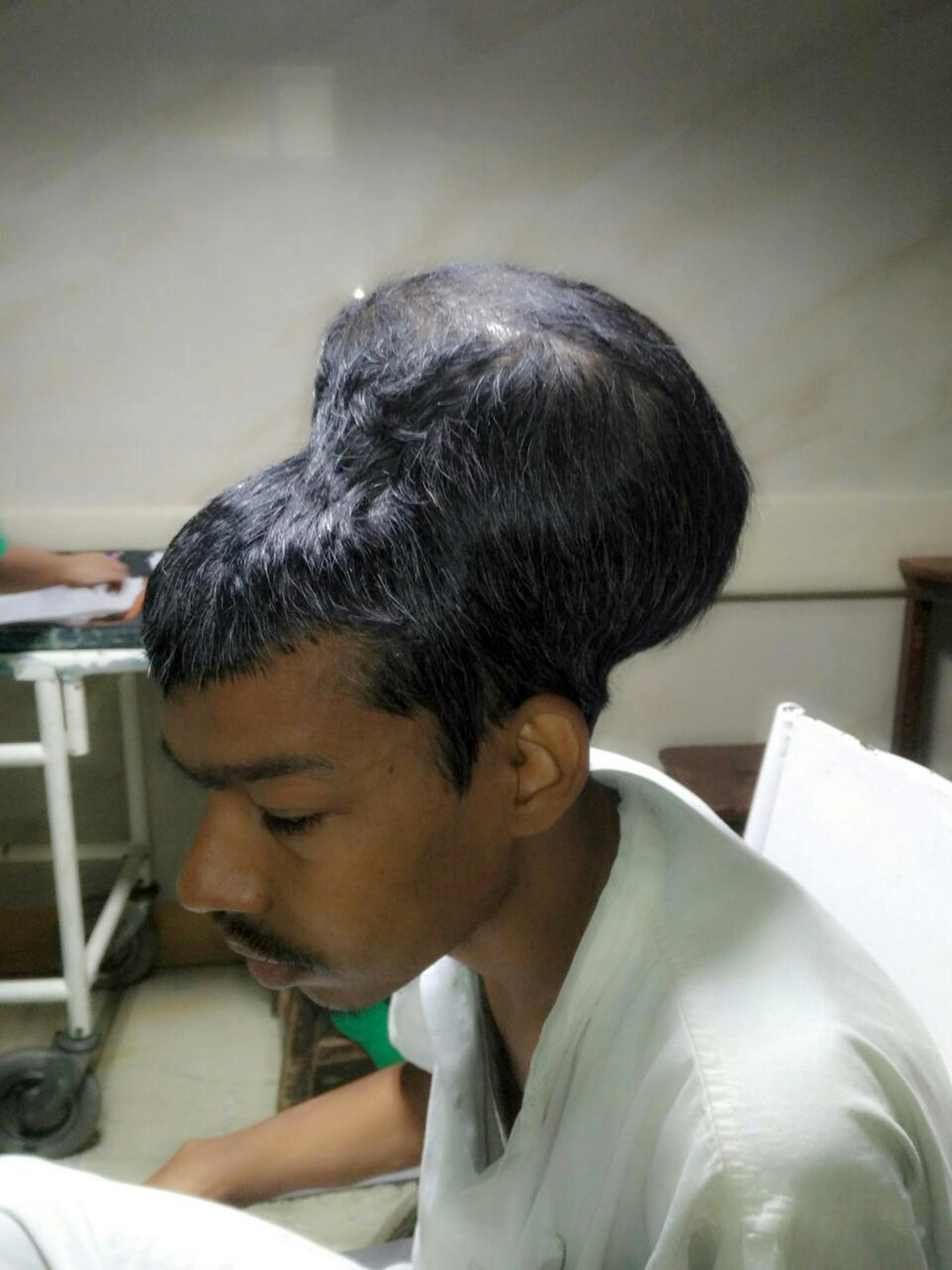 Indien Tumor 1