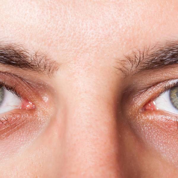 auge