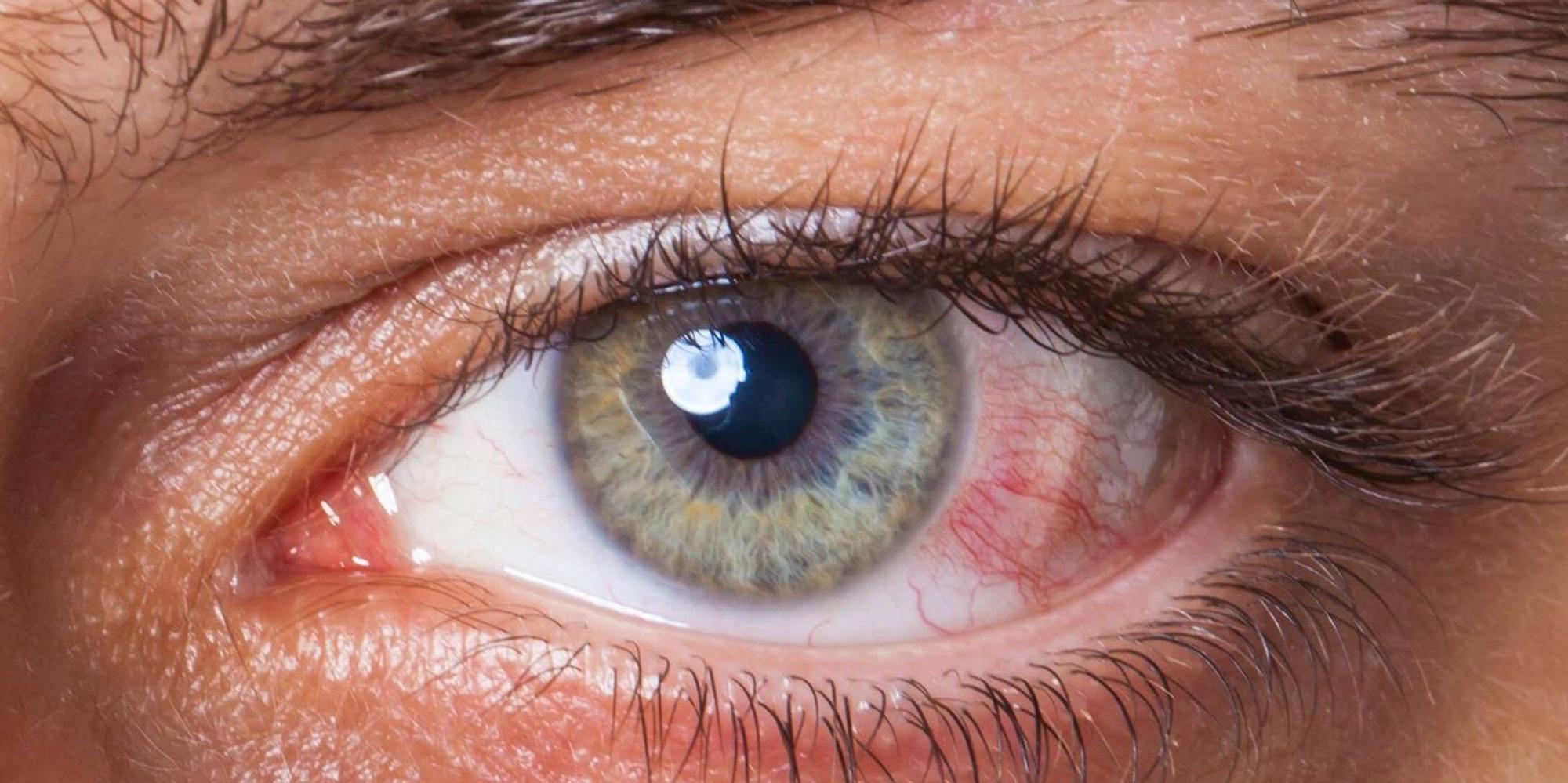auge