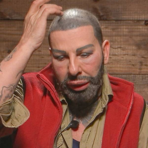 Glööckler IBES 030222