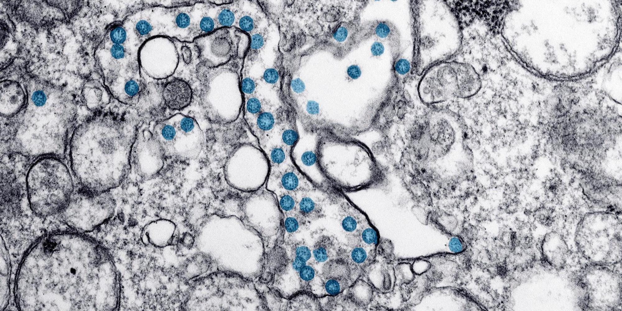 Coronavirus Mikroskop blau