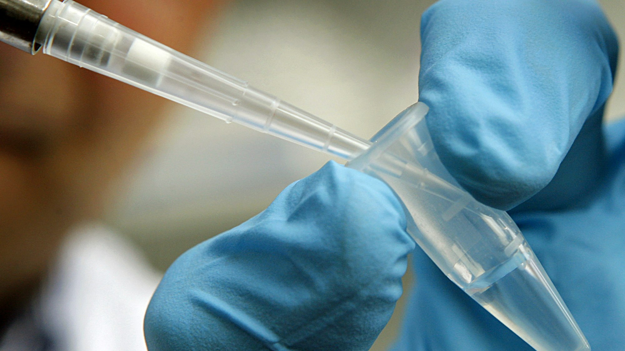 Eine DNA-Probe wird zwischen zwei Fingern gehalten.