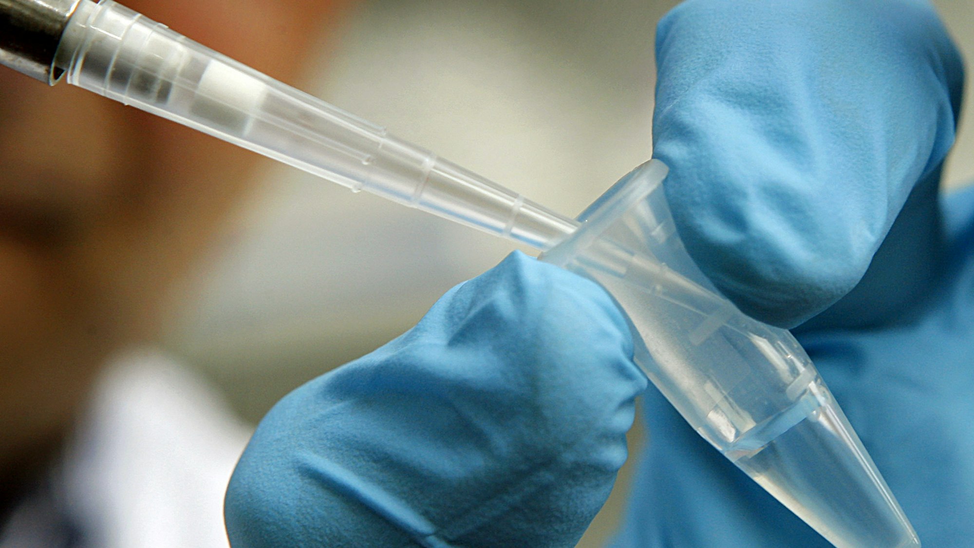 Eine DNA-Probe wird zwischen zwei Fingern gehalten.