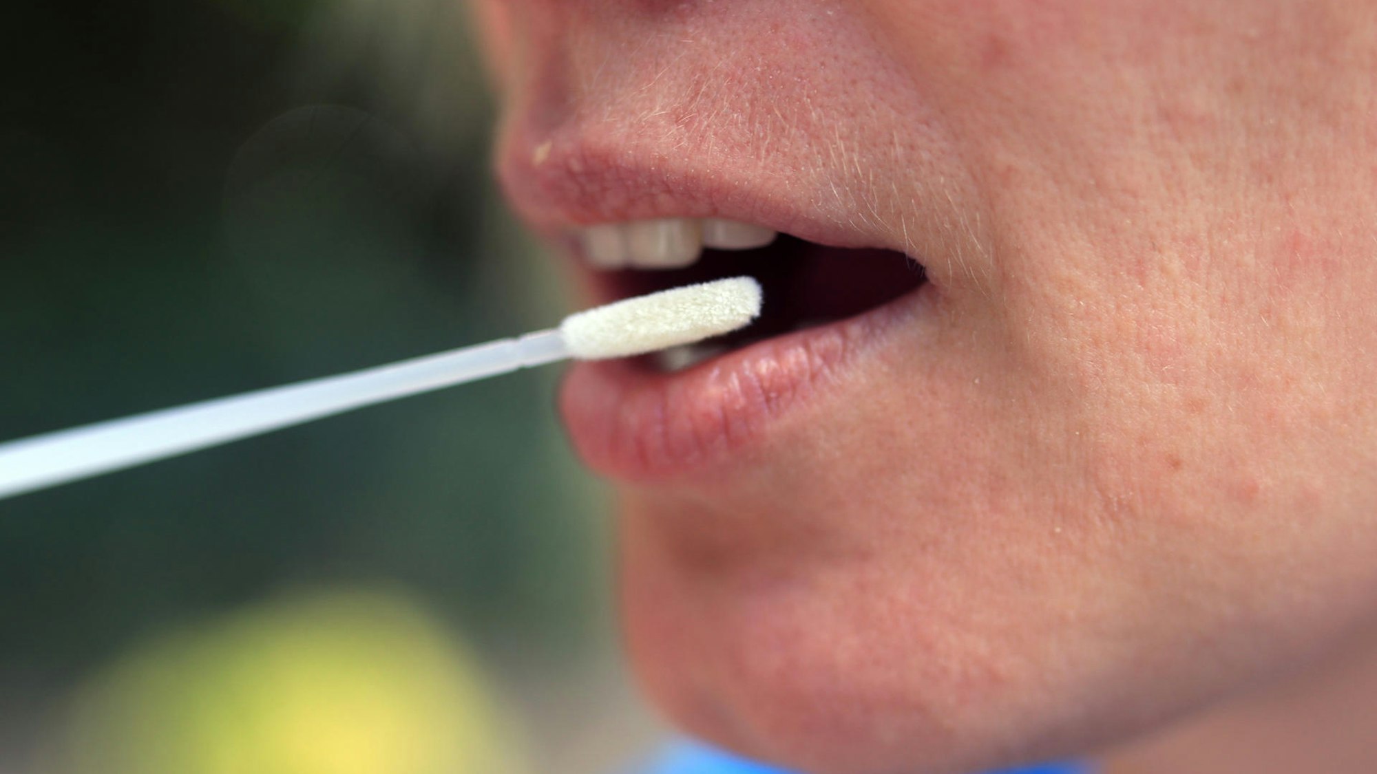 Das Foto zeigt einen offenen Mund und ein Wattestäbchen für einen Abstrich.