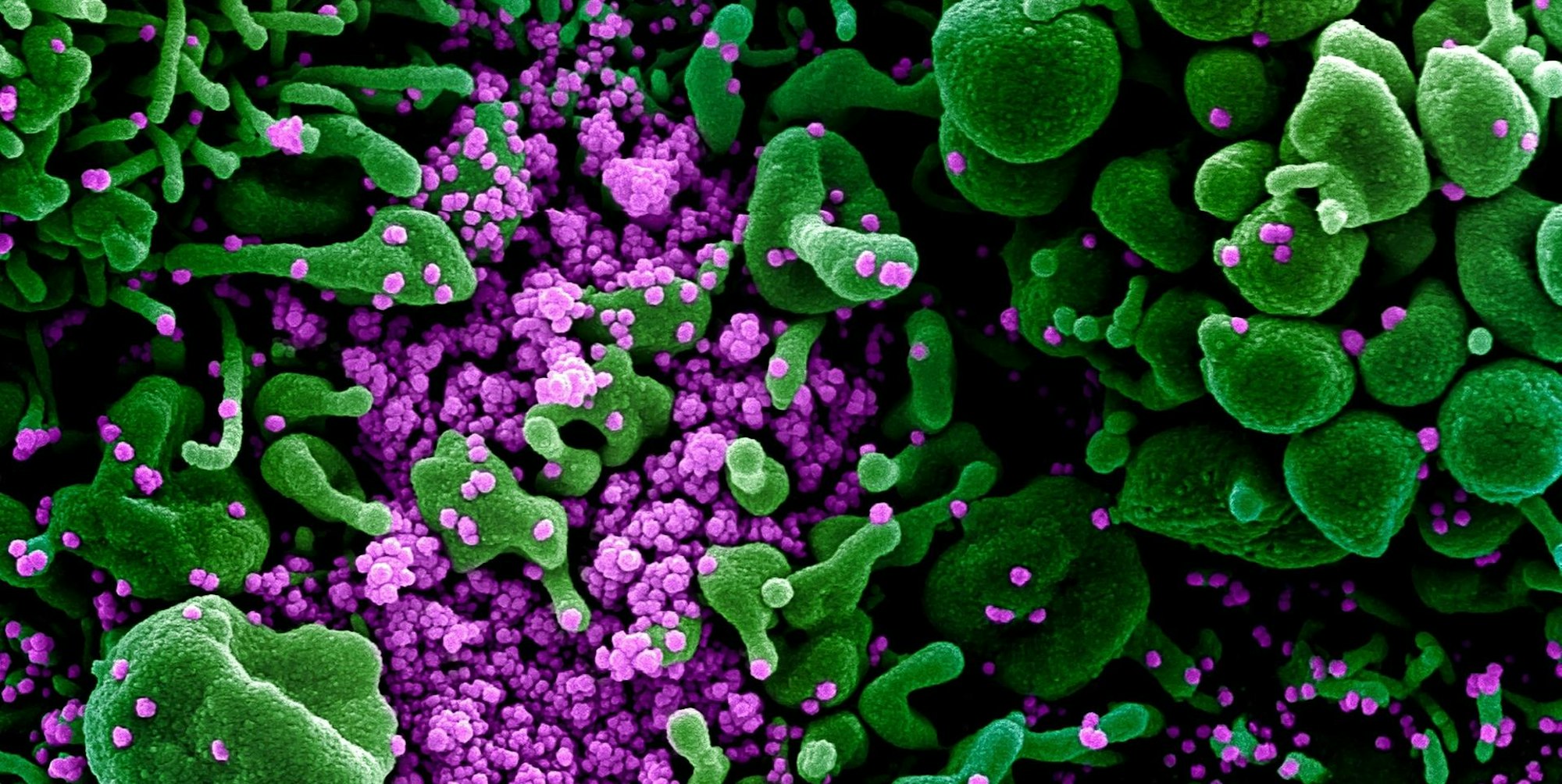 Corona BA 2.75 SYMBOL DPA 130722